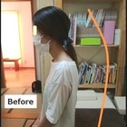 外反母趾の改善　首肩の症状改善